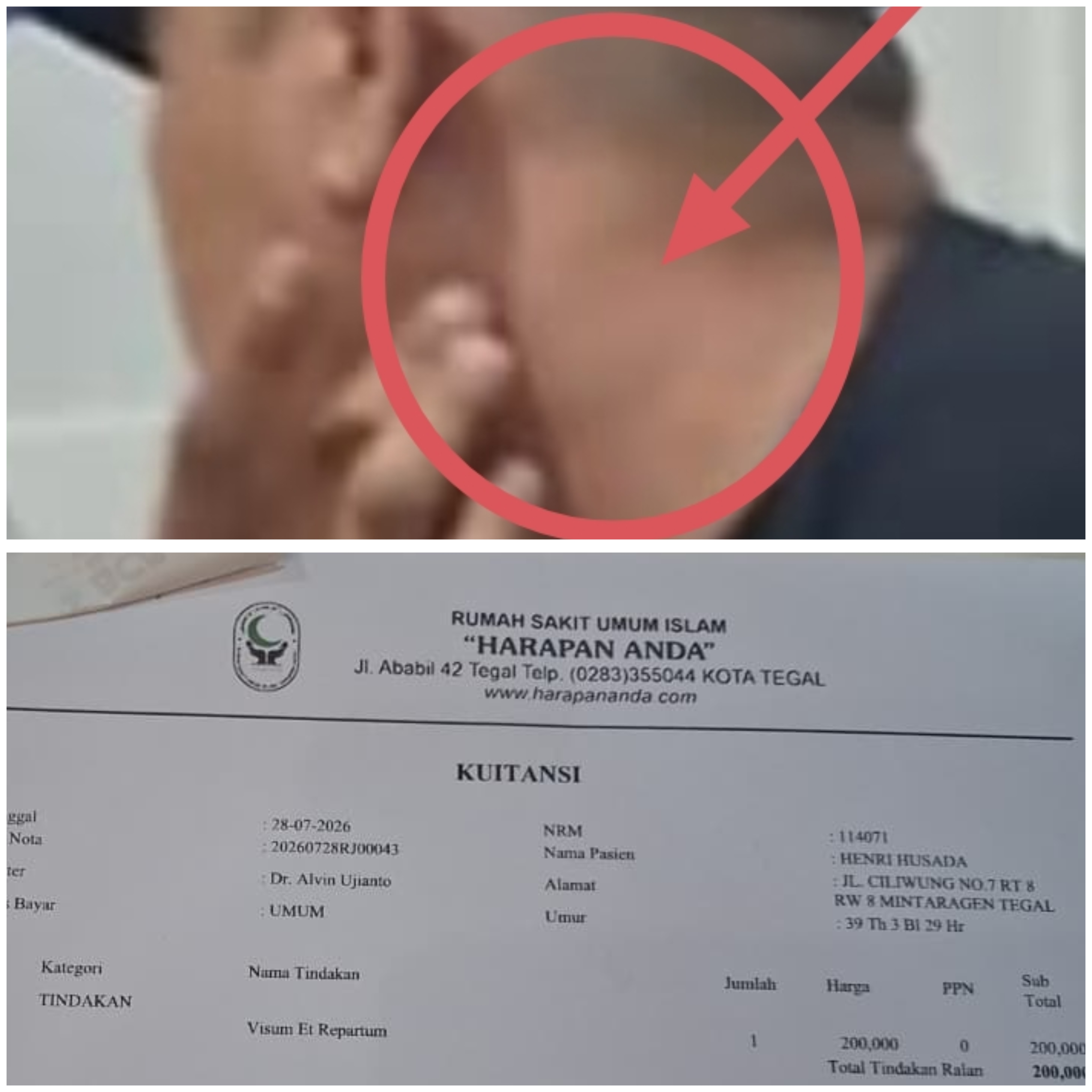 Tempuh Jalur Hukum, Dugaan Kuat Andi Haryanto Pukul Wartawan MeteorNews